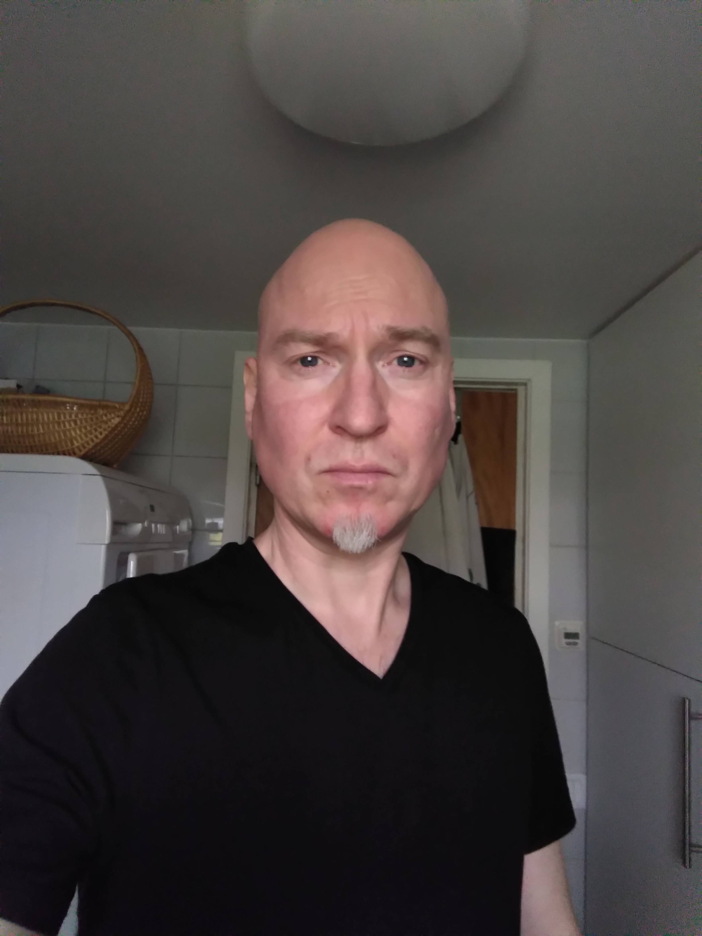 CW: Eye contact. Unhappy bald white man in a black t-shirt standing in a bathroom. Just a little piece of white beard left. Red chin from ecsema.
